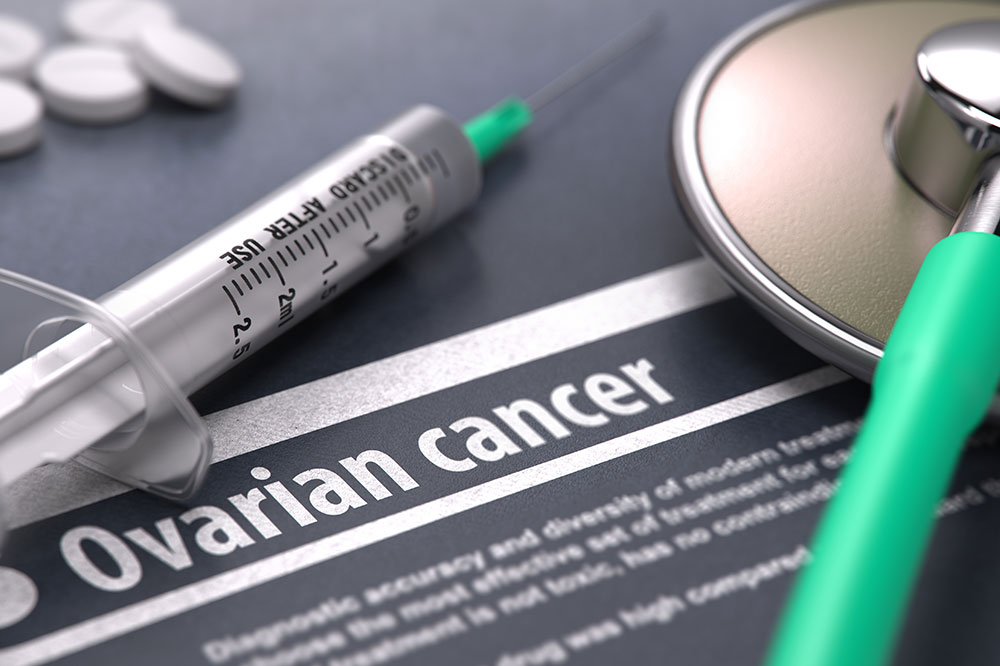 Causes and Symptoms of Ovarian Cancer