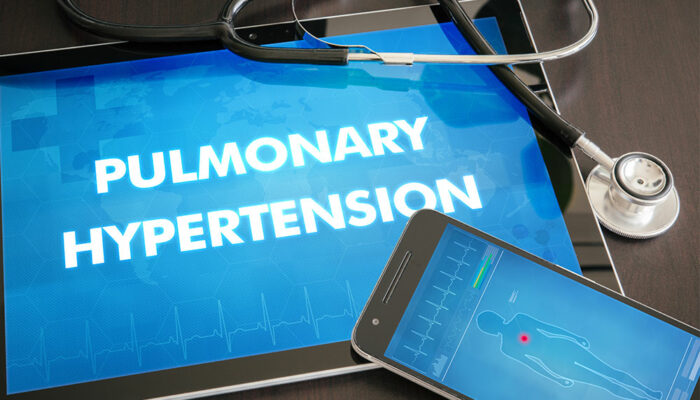 Common Causes and Risk Factors of PAH