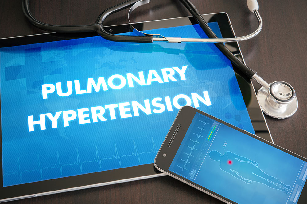 Common Causes and Risk Factors of PAH