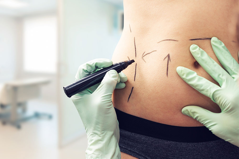 3 Plastic Surgeries for Specific Health Conditions