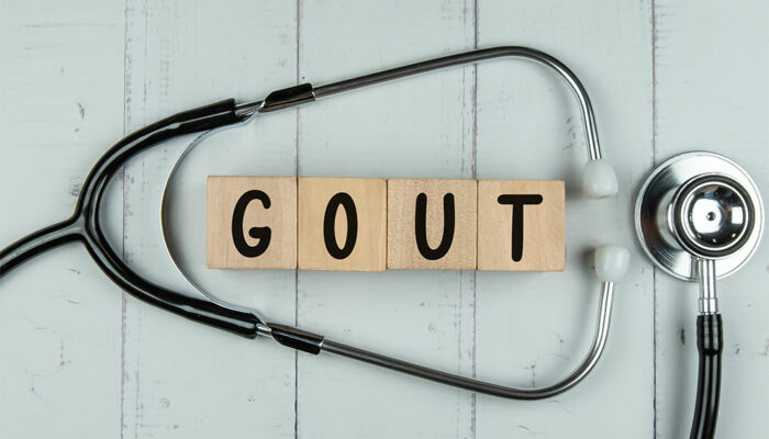 6 Lifestyle Tips to Manage Gout