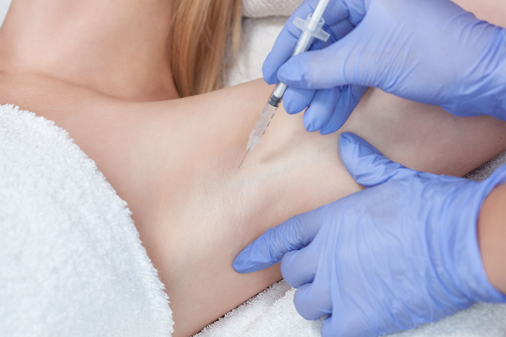 6 Natural Ways to Treat Hyperhidrosis